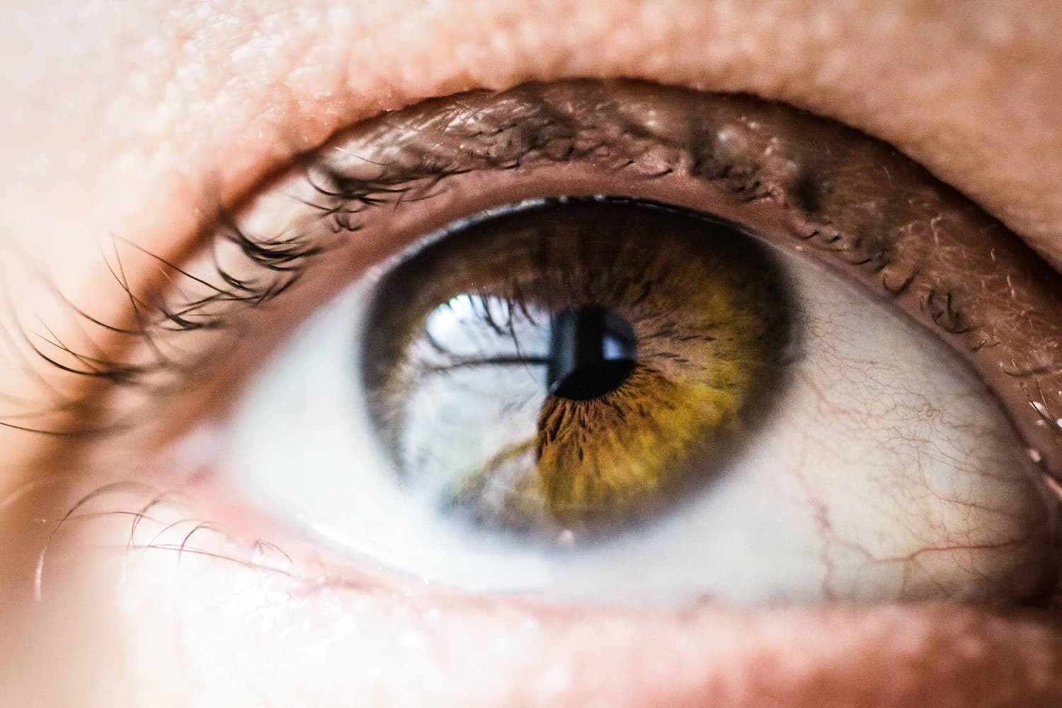 Dry eye treatment at Gazal Eyecare in Roswell, GA