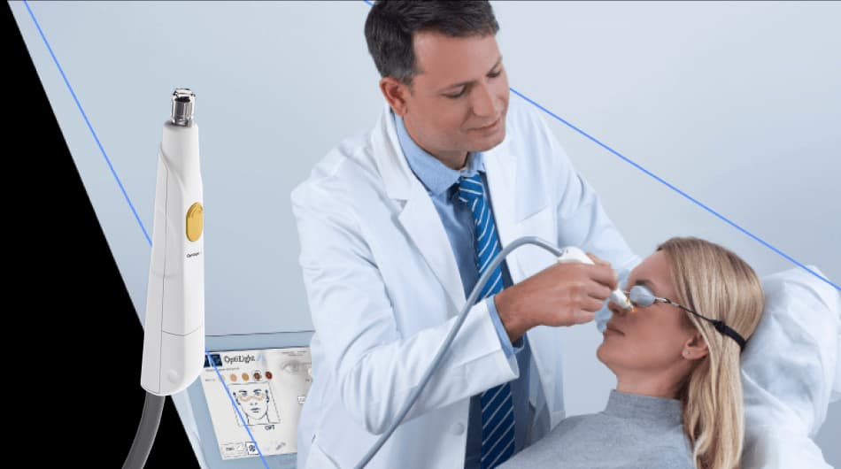 OptiLight IPL (Intense Pulsed Light) dry eye treatment device used at Gazal Eyecare